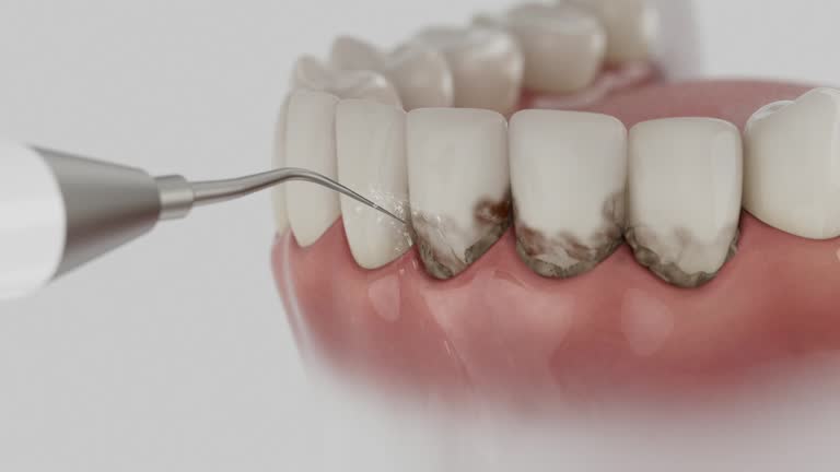 Trusted Teeth Cleaning And Checkup service in Aberdeen, ID - Dentist Open Now